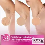 جهاز Philips Lumea 8000 لإزالة الشعر بتقنية IPL!